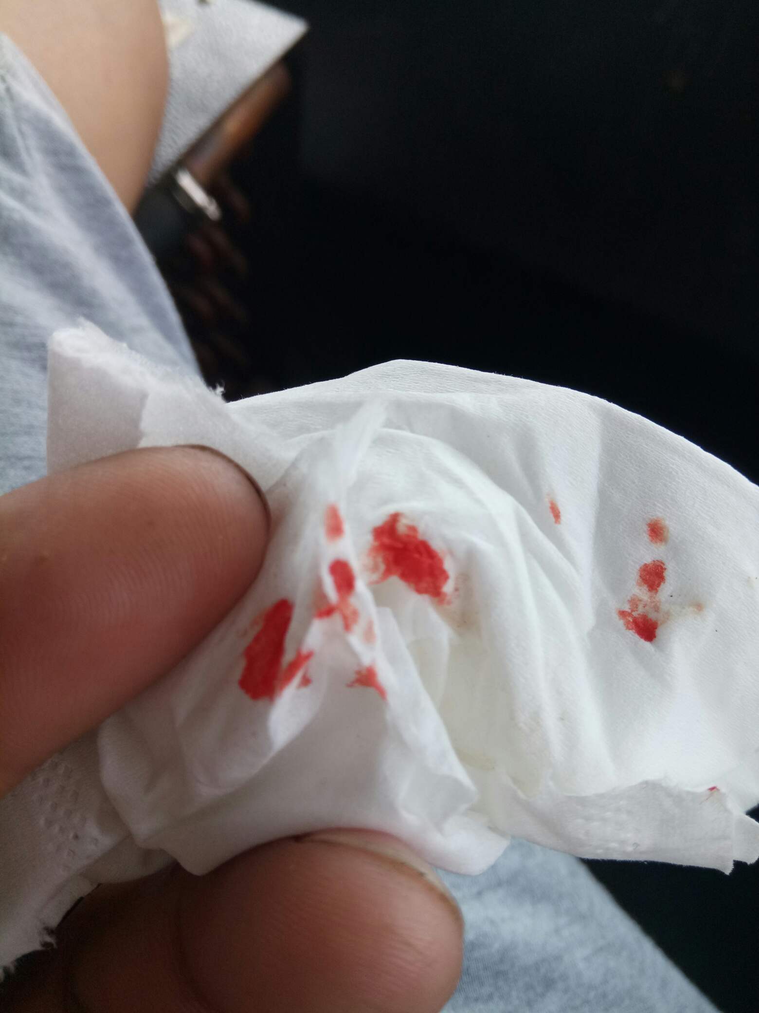 又他妈的干出血了真是没谁了   现在就是血多 钱少 啥时候钱能像血一